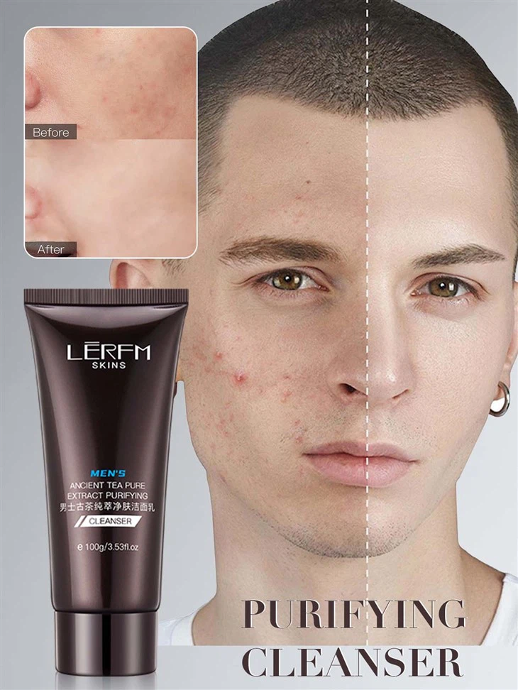 Ansigtsrens til mænd